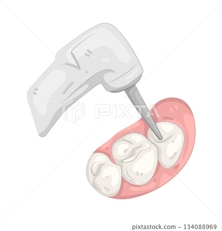 Illustration of tooth drill  134088969
