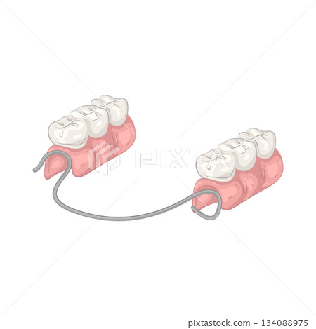 Illustration of partial denture  134088975
