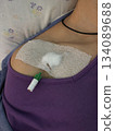 Close up of medical catheter access site covered with sterile dressing on patient's chest in hospital setting, showing healthcare equipment, treatment procedure and clinical care for medical support 134089688
