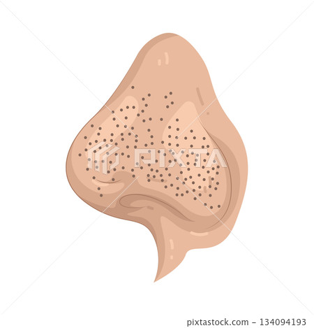Illustration of blackhead Illustration of blackhead 134094193