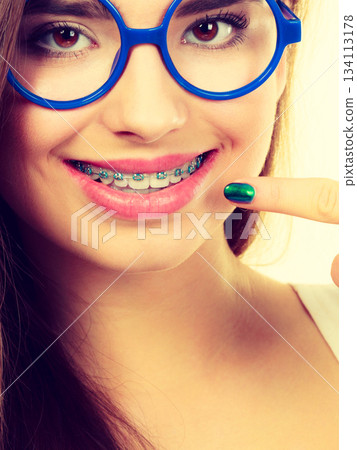Nerdy woman showing her teeth with braces 134113178