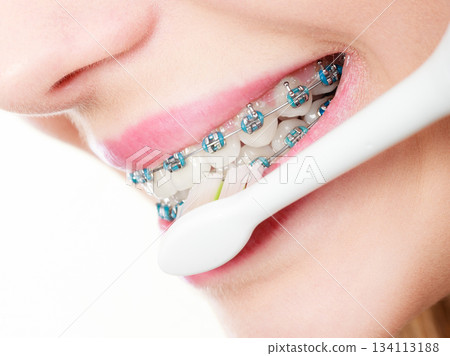 Woman brushing teeth with braces using brush 134113188