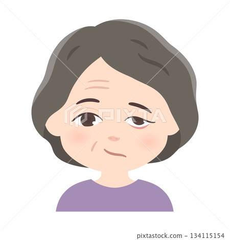 左側面癱示意圖 左側面癱示意圖 134115154