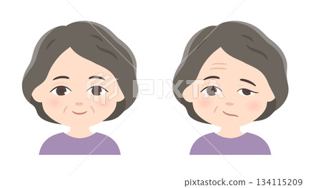 左側面癱的健康老年女性插圖 左側面癱的健康老年女性插圖 134115209