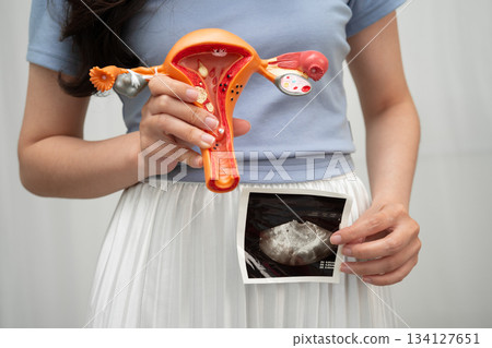 Uterus ultrasound, Asian woman holding human anatomy model. Uterus ultrasound, Asian woman holding human anatomy model. 134127651