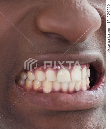 Hyperrealistic 3D render is showing lower face with open lips exposing teeth and gums Hyperrealistic 3D render is showing lower face with open lips exposing teeth and gums 134129960