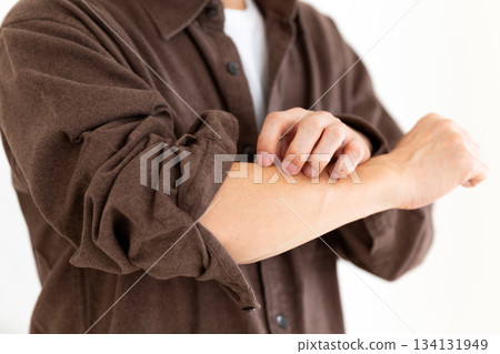 A middle-aged man suffering from dry, itchy skin A middle-aged man suffering from dry, itchy skin 134131949