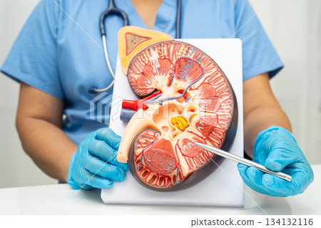 Chronic kidney disease, Asian woman with model for treatment urinary system, urology, Estimated glomerular filtration rate eGFR. Chronic kidney disease, Asian woman with model for treatment urinary system, urology, Estimated glomerular filtration rate eGFR. 134132116