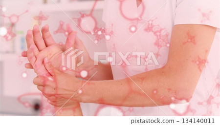 Showing uniformed therapist hands holding patient hand and wrist in clinic, with molecular overlay 134140011