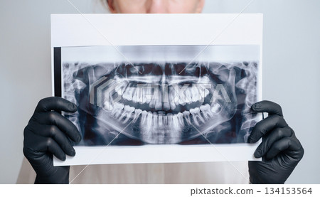 Dentist holding a dental x-ray against a white background with space for text, showing professional oral care Dentist holding a dental x-ray against a white background with space for text, showing professional oral care 134153564