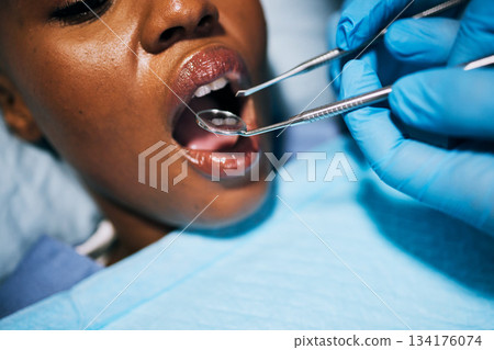 Mouth, woman and hands of dentist in dental surgery for clean teeth, denchers or oral hygiene at clinic. Female in tooth whitening treatment with tools for cleaning gum bacteria, disease or decay 134176074
