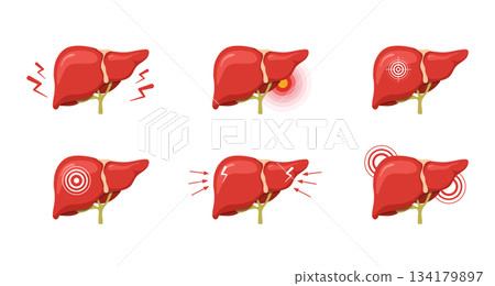 Liver pain. Medical illustration of human liver anatomy. Disease treatment and healthcare icons. Vector design Liver pain. Medical illustration of human liver anatomy. Disease treatment and healthcare icons. Vector design 134179897