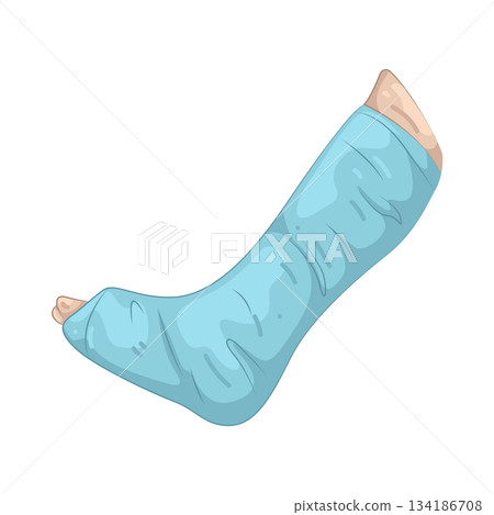 Illustration of leg cast Illustration of leg cast 134186708