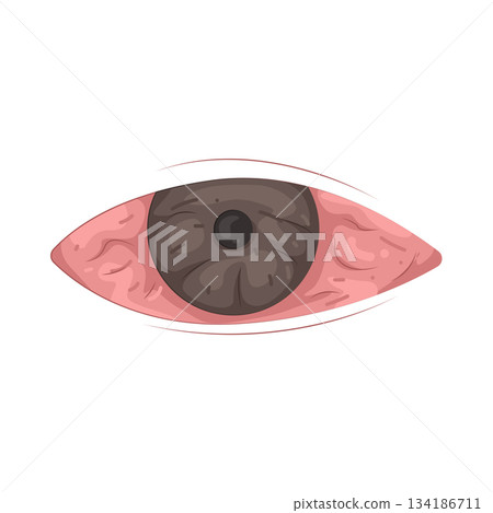 Illustration of red eye  134186711