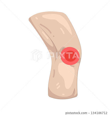 Illustration of knee pain 134186712
