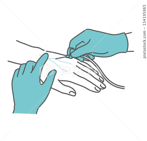 Illustration of securing an intravenous route (venipuncture) 134195865
