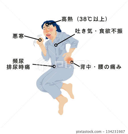 醫學插圖,描繪了一名女性患者出現腎盂腎炎症狀:高燒、寒顫、腰痛和排尿疼痛。 醫學插圖,描繪了一名女性患者出現腎盂腎炎症狀:高燒、寒顫、腰痛和排尿疼痛。 134231987