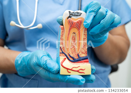 Dentist holding dental implant, artificial tooth roots into jaw, root canal of dental treatment, gum disease, teeth model for dentist. 134233054