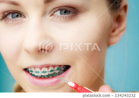 Woman with teeth braces using interdental brush 134243232