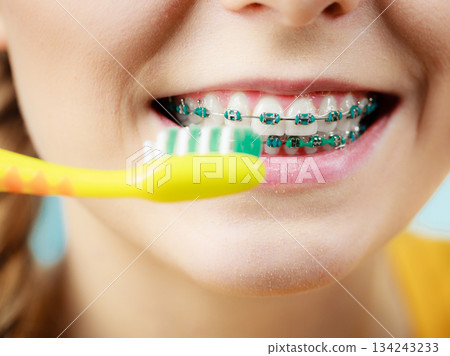 Woman with teeth braces using brush Woman with teeth braces using brush 134243233