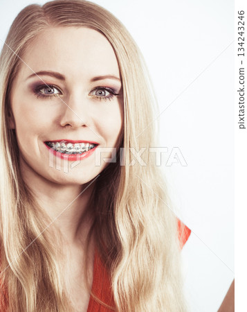 Elegant woman showing her teeth with braces Elegant woman showing her teeth with braces 134243246
