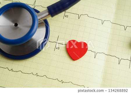 Stethoscope on electrocardiogram (ECG), heart wave, heart attack, cardiogram report. Stethoscope on electrocardiogram (ECG), heart wave, heart attack, cardiogram report. 134268892