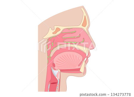 Postnasal drip poster 134273778