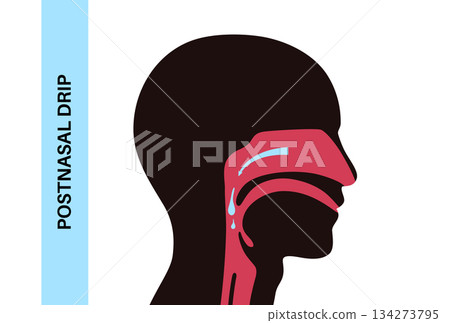 Postnasal drip poster 134273795