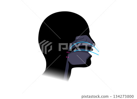 Obstructive sleep apnea Obstructive sleep apnea 134273800