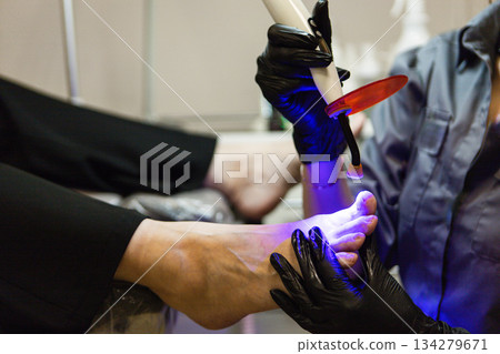 Podiatrist treating nail disorders using violet woods lamp light Podiatrist treating nail disorders using violet woods lamp light 134279671