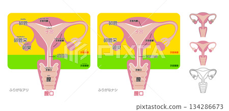 女性生殖系統示意圖及其各部份名稱：子宮、輸卵管、卵巢、陰道、子宮頸 134286673