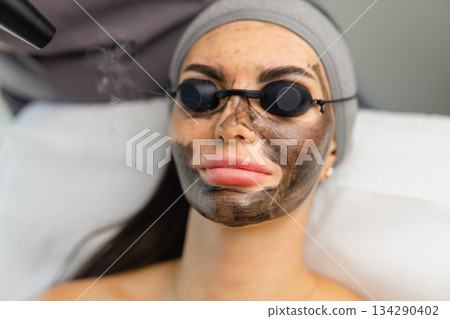 Carbon laser facial procedure in a beauty clinic with a woman wearing protective eye shields and a carbon mask during treatment. 134290402