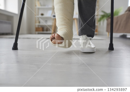 Unhealthy young woman with broken leg or foot injury is undergoing rehabilitation at home. Girl is standing in the living room on crutches with bandaged leg Unhealthy young woman with broken leg or foot injury is undergoing rehabilitation at home. Girl is standing in the living room on crutches with bandaged leg 134293897