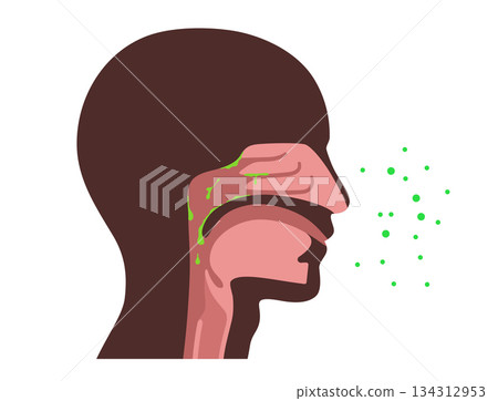 Postnasal drip poster 134312953