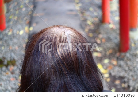 A top-down view of a senior woman's scalp and concerns about gray and thinning hair while visiting a shrine A top-down view of a senior woman's scalp and concerns about gray and thinning hair while visiting a shrine 134319086