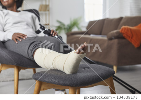 Woman with a broken leg in a plaster cast sitting on a chair, with her foot resting on a stool Woman with a broken leg in a plaster cast sitting on a chair, with her foot resting on a stool 134339173