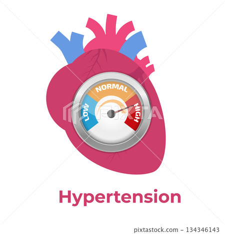 High blood pressure, hypertension concept. Vector illustration. High blood pressure, hypertension concept. Vector illustration. 134346143