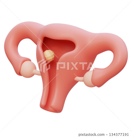 uterus and implantation cartoon style 3D graphic 134377191