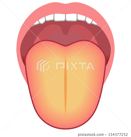 Yellow tongue - Health status as determined by the tongue - Tongue diagnosis - Tongue health Yellow tongue - Health status as determined by the tongue - Tongue diagnosis - Tongue health 134377252