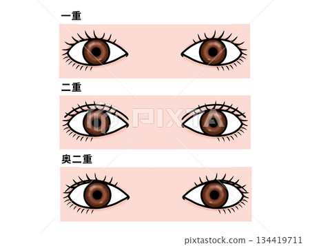 單眼、雙眼與深陷眼 134419711