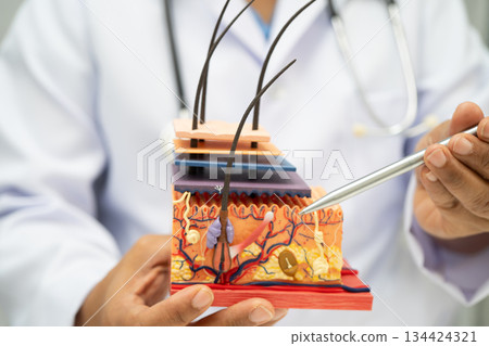 Asian dermatologist doctor holding skin structure model anatomy for treatment in hospital, hair transplant. Asian dermatologist doctor holding skin structure model anatomy for treatment in hospital, hair transplant. 134424321