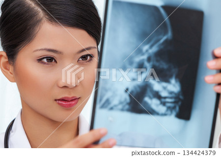 Chinese Female Woman Hospital Doctor Looking at Skull X-Ray Chinese Female Woman Hospital Doctor Looking at Skull X-Ray 134424379