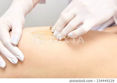 Arm of female applying hair removal wax with gloved hands on leg Arm of female applying hair removal wax with gloved hands on leg 134449129