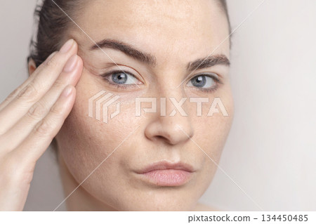 Age-related changes on the face of a middle-aged woman. First wrinkles. A woman thinks about a facelift, plastic surgery. Cropped photo close up Age-related changes on the face of a middle-aged woman. First wrinkles. A woman thinks about a facelift, plastic surgery. Cropped photo close up 134450485