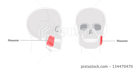 Masseter - Human chewing muscle shown in diagram responsible for elevating the mandible, crucial for biting 134470470