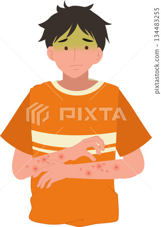 a man with eczema dermatitis and red rash on arms showing allergy symptoms a man with eczema dermatitis and red rash on arms showing allergy symptoms 134483255
