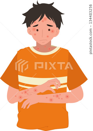 skin allergy and dermatitis symptoms shown on man medical illustration skin allergy and dermatitis symptoms shown on man medical illustration 134483256