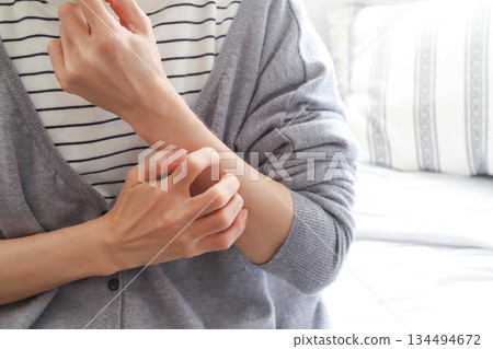 Woman scratching her arm, atopic eczema Woman scratching her arm, atopic eczema 134494672