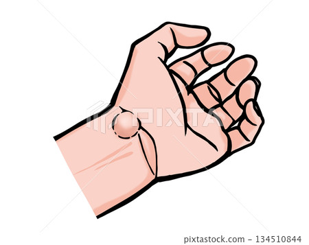一隻手長有腱鞘囊腫的插圖 134510844