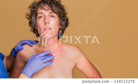 Doctor examining woman with eczema skin problems 134515278